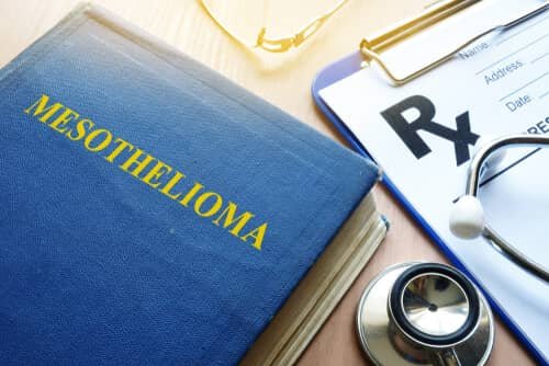 Mesothelioma Law Firm Jobs (NOW HIRING):